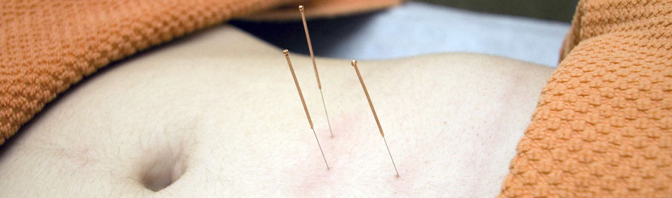 Accupuncture, Eastern Healing Arts in the Northampton County, PA area